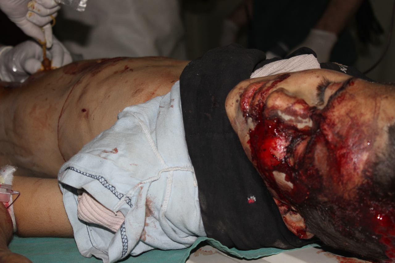 أكثر من أربعين شهيداً بغارات ا...