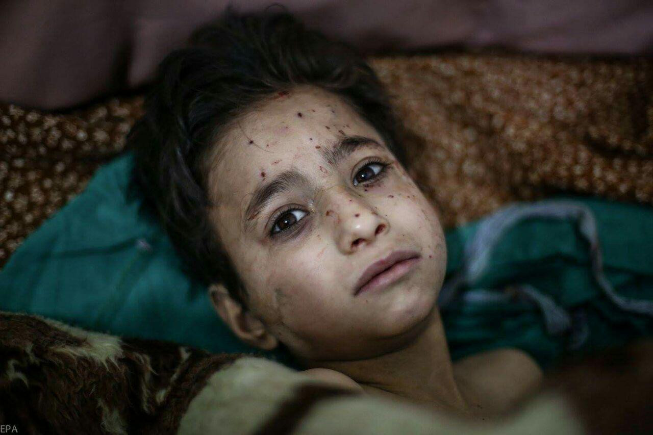 الأوبئة والأمراض السارية تهاجم...