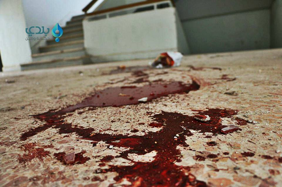 نصفهم أطفال ونساء.. سوريا ودعت...