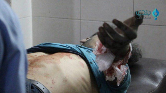 حصيلة شهداء الغوطة ترتفع إلى 2...