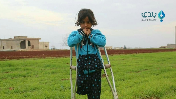 الطفلة "ملك" تحلم بطرف صناعي ل...