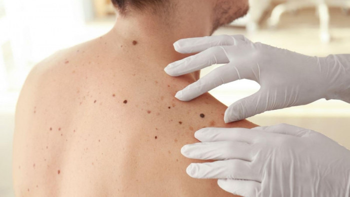 أعراض صغيرة لأمراض خطيرة.. تعر...