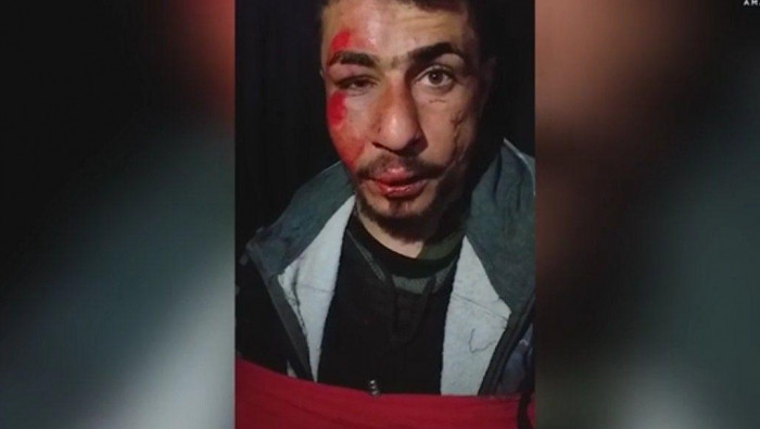 داعش يذبح عنصراً من قسد في دير...