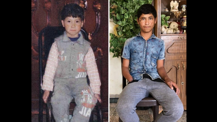 طفل سوري يحظى باهتمام وسائل ال...