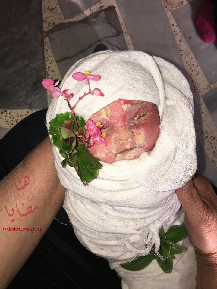 وفاة مولود بعد أيام من وفاة شق...