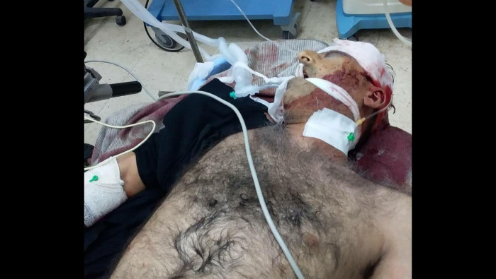 عمليات الاغتيال تتواصل وتطال ر...