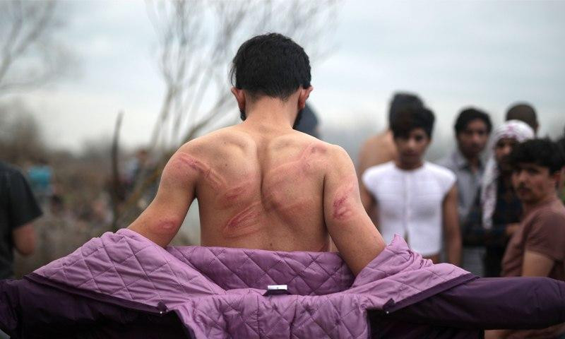 صور صادمة للاجئين سوريين تعرضو...