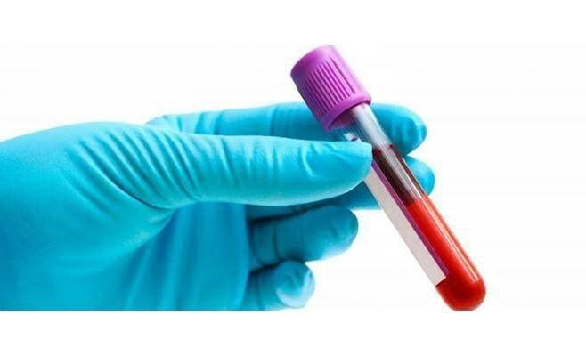 فصيلة دمك تحدد نسبة إصابتك بفا...