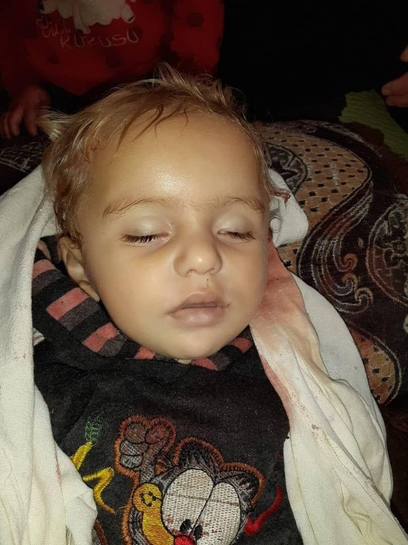 وفاة طفلة بطلق ناري في إدلب