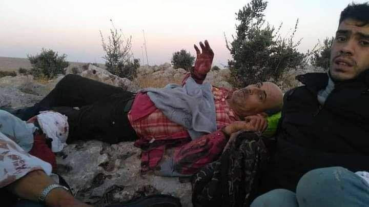 حلب.. حقل ألغام يفتك بعشرات ال...