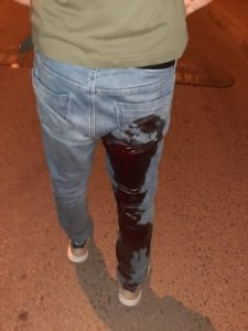 العنصرية مجددا.. شاب سوري يتعر...