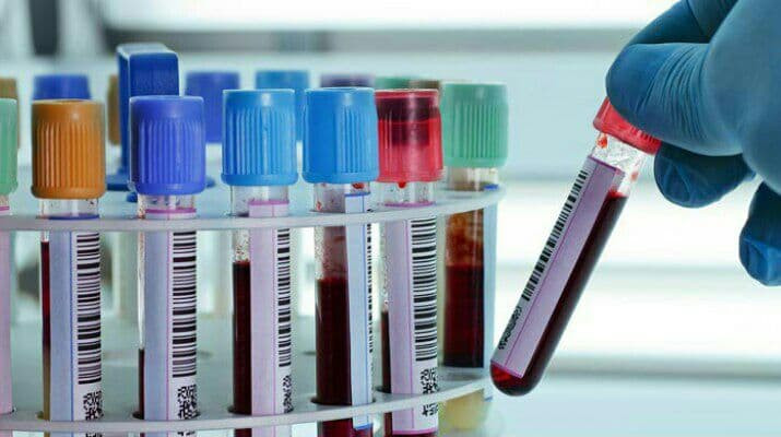 "وزارة الصحة" ترفع تسعيرة تحال...