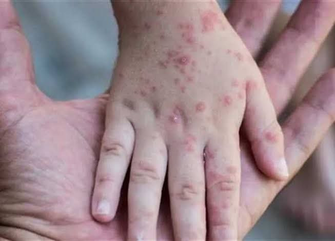 صحة النظام: لا وجود لإصابات بج...