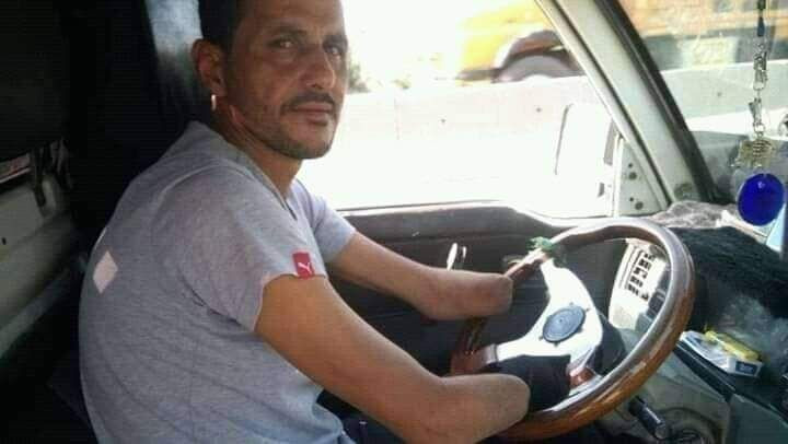 فقد يديه أثناء قتاله مع النظام...