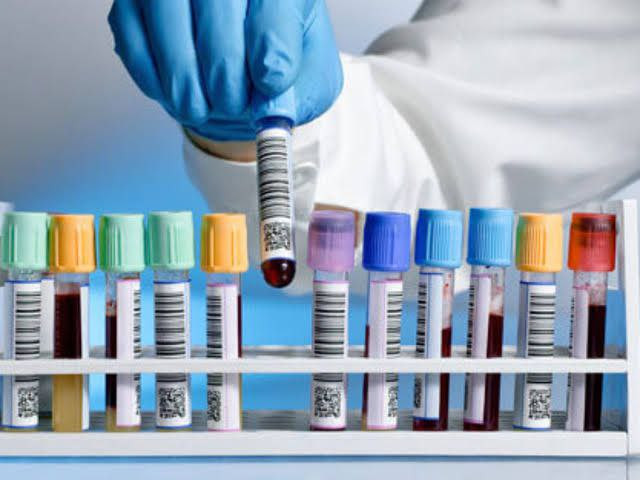 تكاليف التحاليل الطبية "مزاجية...