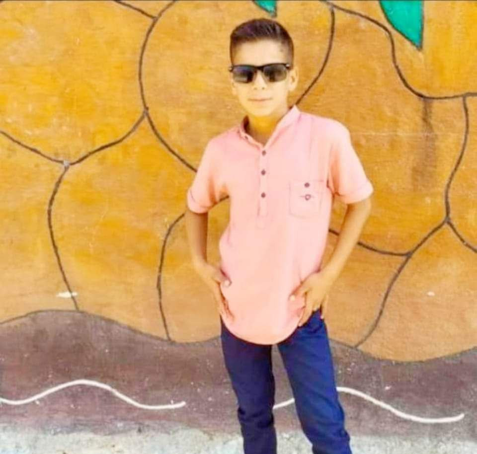 عضة كلب تنهي حياة طفل في ريف ح...