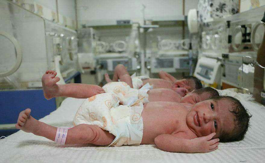 ولادة ثلاثة توائم في الغوطة ال...