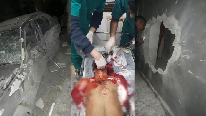 جرحى مدنيون بقصف مدفعي لـ"ب ي...