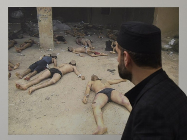 ضحية تعذيب في معتقلات النظام ت...