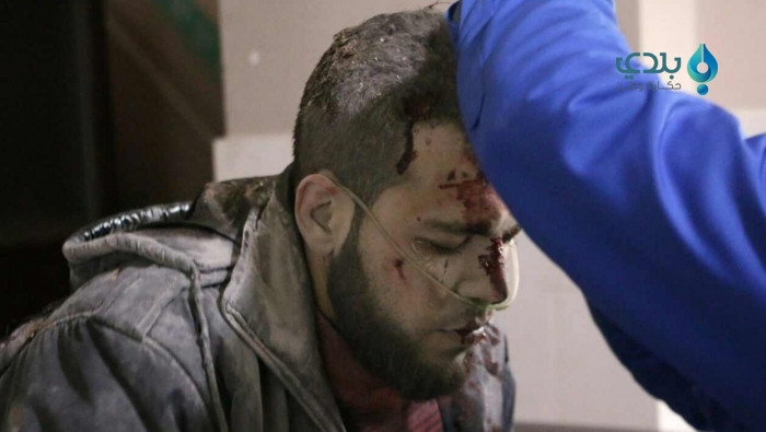 شهيدان وجرحى بقصف النظام غوطة...