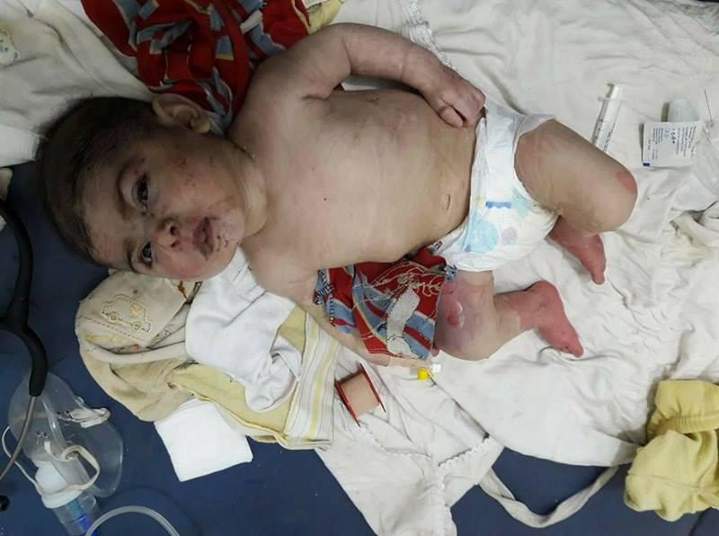 10 ساعات تحت الأنقاض.. الدفاع...