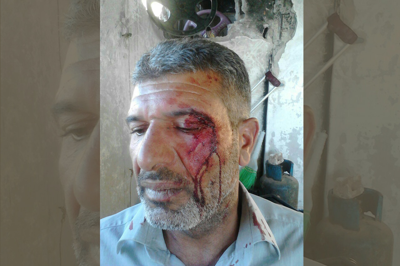 مسلحون يعتدون بالضرب على حقوقي...