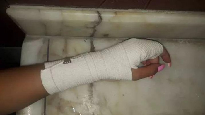 إصابة فتاة بجروح بعد تعرض شبان...