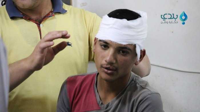 جرحى بانفجار قنبلة من مخلفات ا...