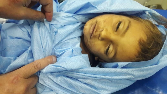 ثلاثة شهداء بقصف مدفعي للنظام...