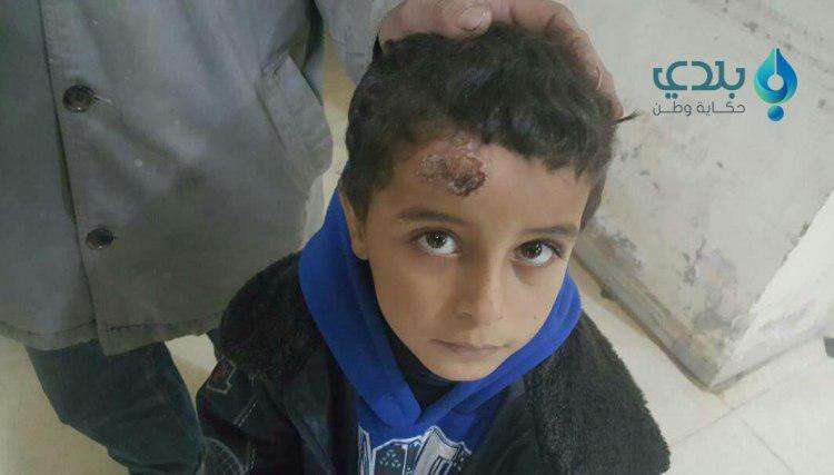 4600 إصابة بـ "اللشمانيا" في ح...