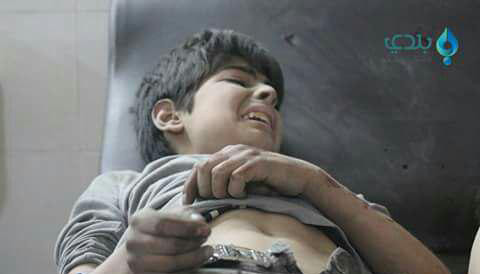 بينهم طلاب مدارس.. جرحى بقصف ا...