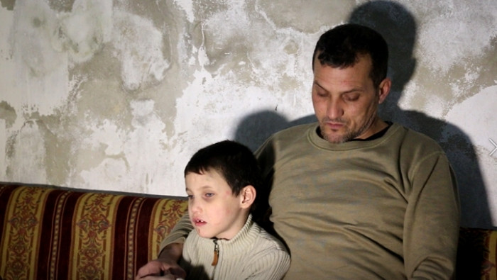 حرمه الأسد البصر.. والد طفل سو...