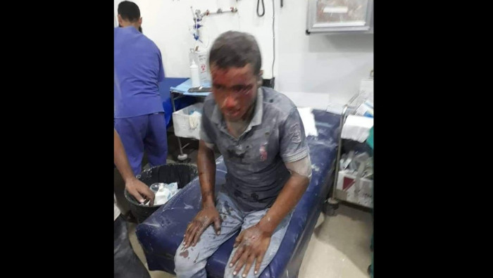 جرحى بانفجار ناسفة غرب حلب