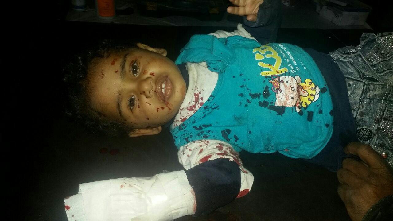 جرحى بينهم أطفال بقصف جوي على...